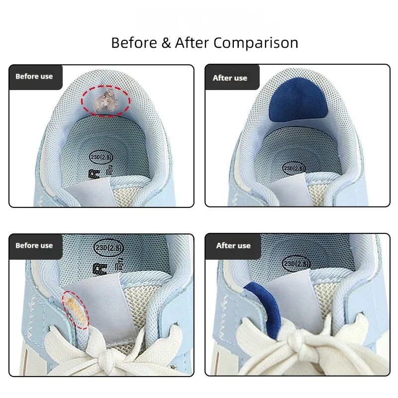 6 Buah Tambalan Perbaikan Sepa - Life Sneaker Care ulasan dan harga
